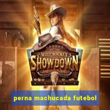 perna machucada futebol